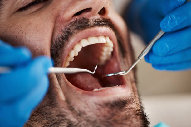 Best Broken or Chipped Tooth Repair in Heeia, HI